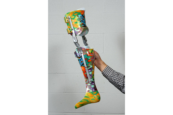 Orthotics and Prosthetics leg, decorated with colorful designs